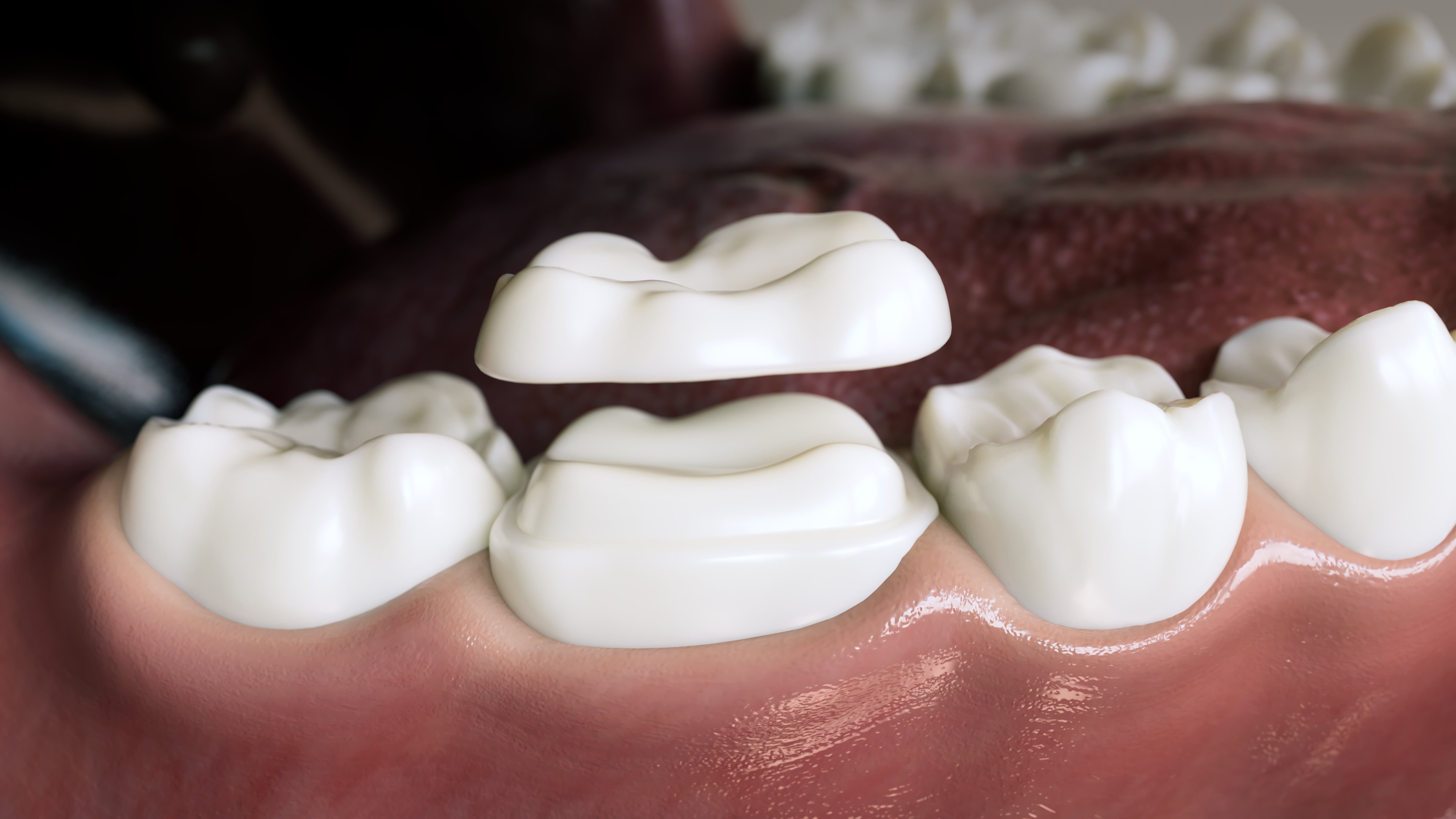 Restorative Dentistry Restorative Dentistry